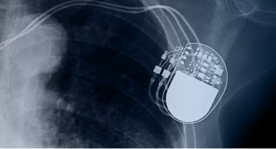 Cardiac Rhythm Management - Pacemaker and Defibrillator Devices ...