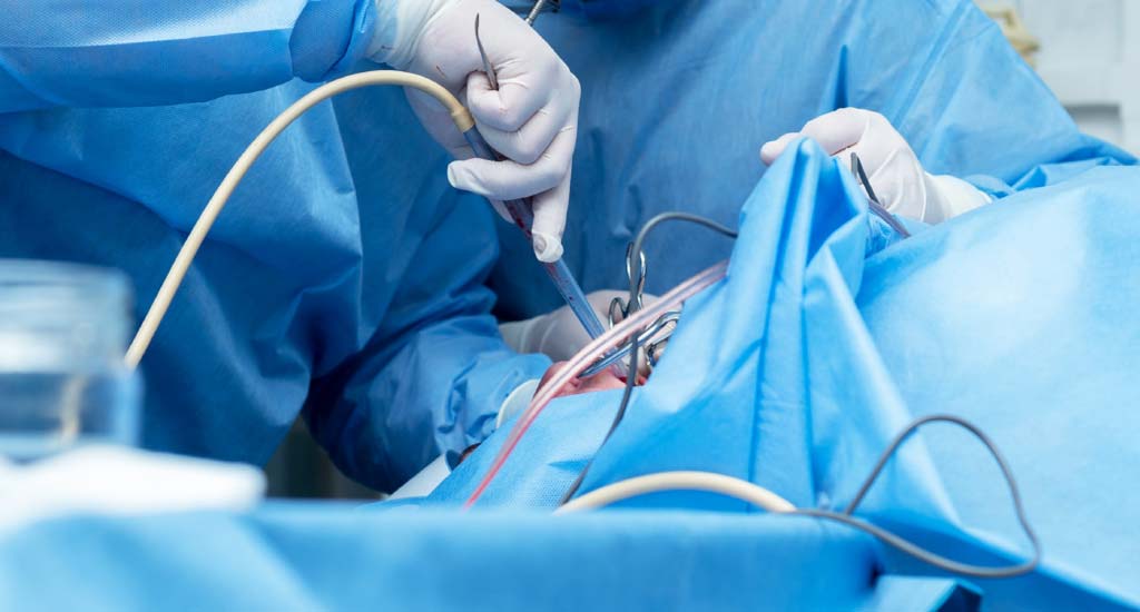 Electrosurgical Instruments